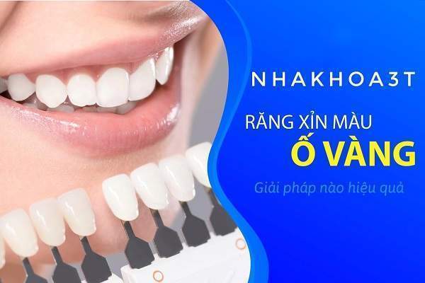 ?giá tẩy trắng răng,tẩy trắng răng giá bao nhiêu,tẩy trắng răng tại nhà,tẩy trắng răng tại phòng khám,tẩy trắng răng laser,bảo hiểm y tế