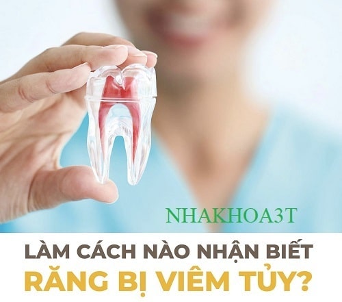 Viêm Tủy Răng Có Nguy Hiểm Không & Không Lấy Tủy Răng Có Sao Không