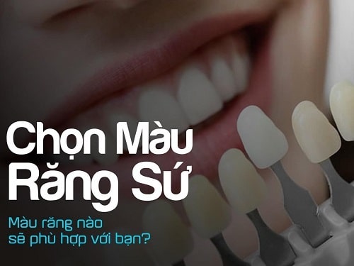 Cách Chọn Màu Răng Sứ Phù Hợp & Bọc Răng Sứ Nên Chọn Màu Răng Nào?