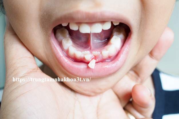 Lưu Ý Khi Trẻ Mọc Răng