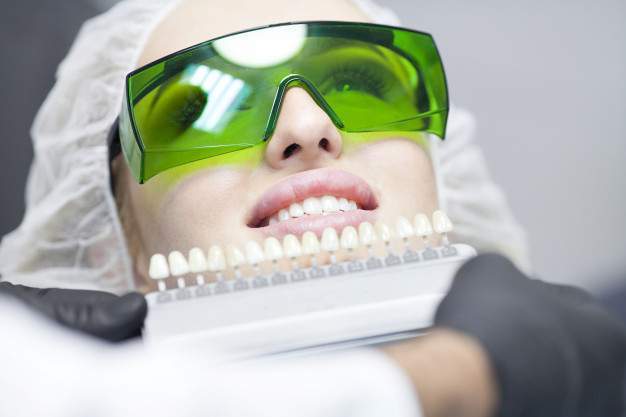 Tẩy Trắng Răng & 5 Điều Cần Biết Trước Khi Thực Hiện Tẩy Trắng Răng