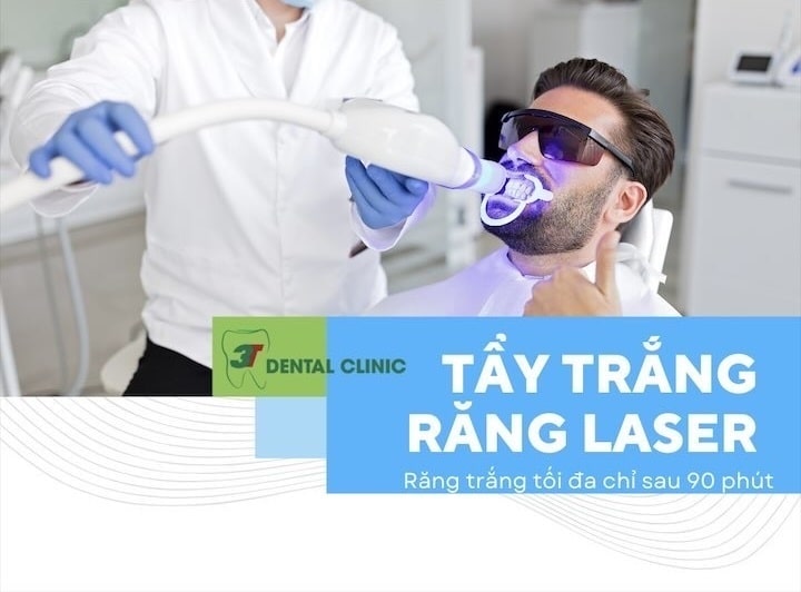 tẩy trắng răng laser